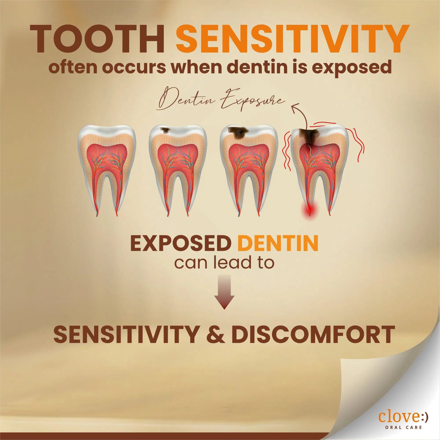Clove Sensitive Tooth Sensitivity and Discomfort